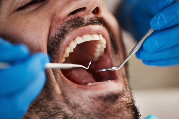 Best Broken or Cracked Tooth Emergency Dentist in Everson, WA