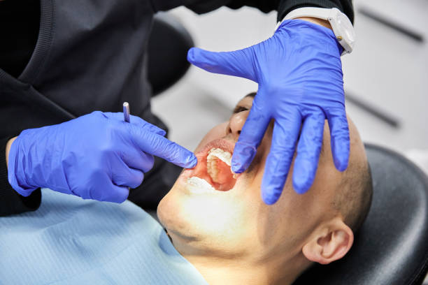 Best Emergency Dentist for Knocked-Out Tooth in Everson, WA